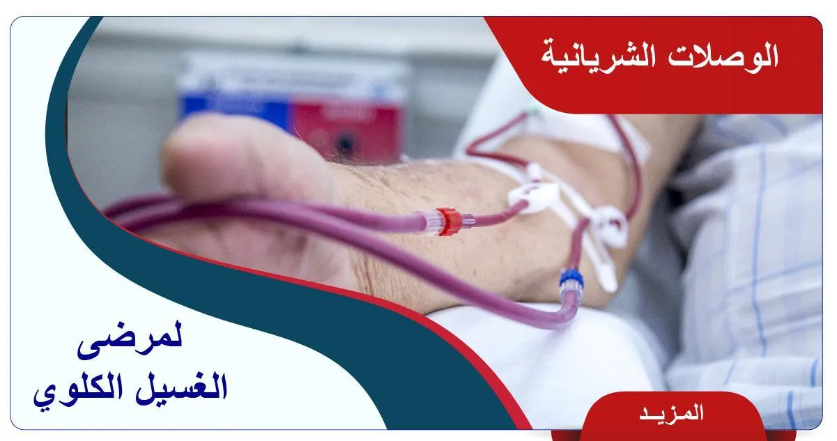 الوصلات الشريانية لمرضى الغسيل الكلوي